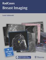 Breast imaging 11th International Workshop, IWDM 2012, Philadelphia, PA, USA, July 8-11, 2012 : proceedings /