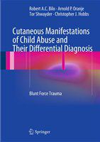 Cutaneous manifestations of child abuse and their differential diagnosis blunt force trauma /