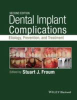 Dental implant complications etiology, prevention, and treatment /