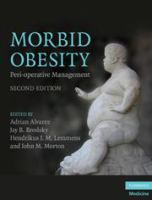 Morbid obesity peri-operative management /