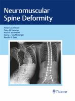 Neuromuscular spine deformity