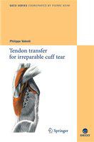 Tendon transfer for irreparable cuff tear