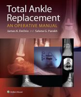 Total ankle replacement an operative manual /
