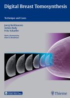 Digital breast tomosynthesis technique and cases /