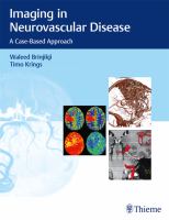 Imaging in neurovascular disease a case-based approach /