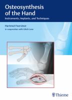 Osteosynthesis of the hand instruments, implants, and techniques  /