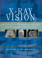 X-ray vision the evolution of medical imaging and its human significance /