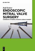 Endoscopic mitral valve surgery handbook of minimal-invasive cardiac surgery /