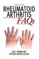 Rheumatoid Arthritis FAQs.