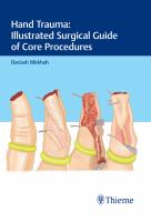 Hand trauma illustrated surgical guide of core procedures /