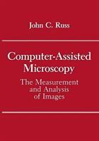 Computer-assisted microscopy : the measurement and analysis of images /