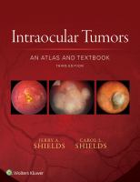 Intraocular tumors an atlas and textbook /